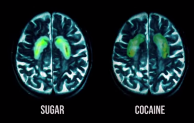 Sugar:Cocaine